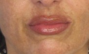 Julie maquillaje semipermanente labios después (Copy)